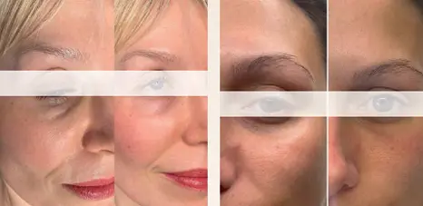 s after treatment